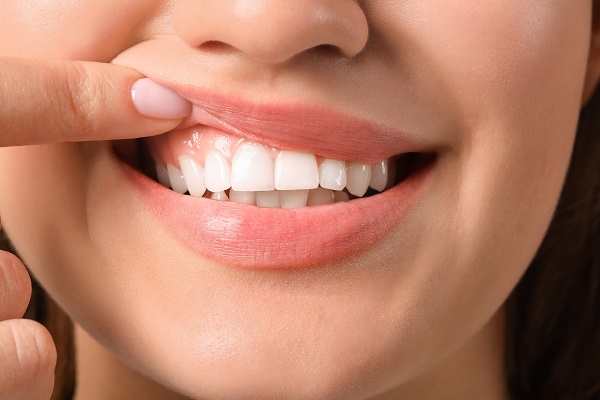 How Treating Gum Disease Can Improve Your Smile